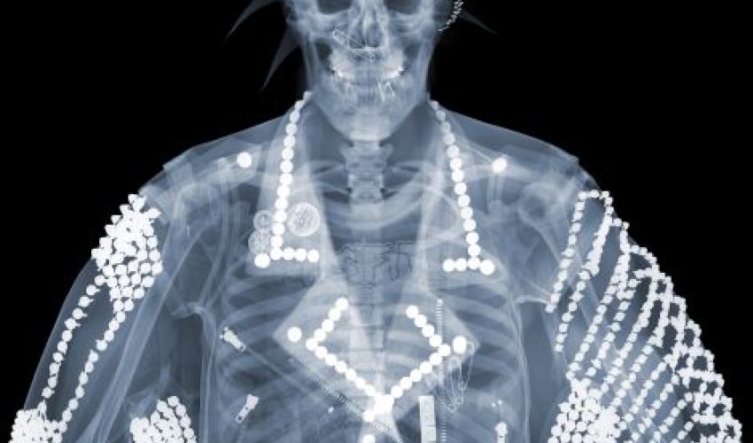 X-ray 'voyeur's' artwork provides a surprising glimpse... - PHOTO