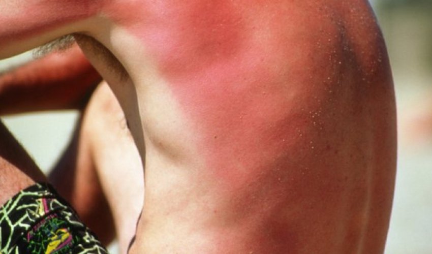 Sunbathing 'may be addictive' warning - PHOTO Sunbathing 'may be addictive' warning - PHOTO