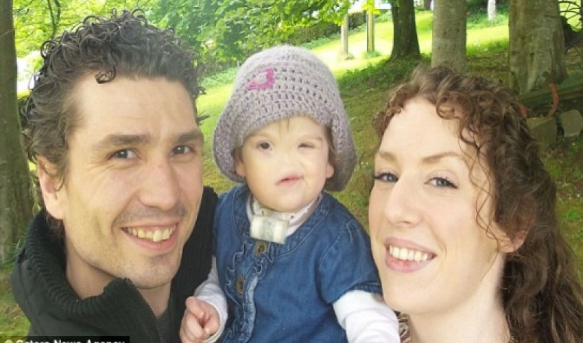 The girl born without a nose - PHOTO+VIDEO
