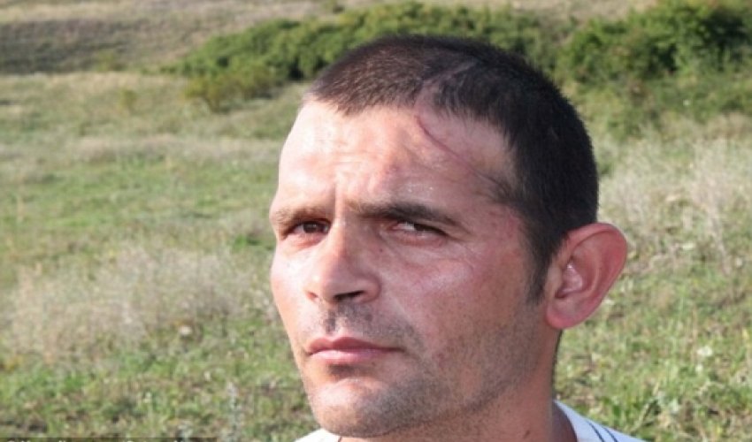 Builder has his head rebuilt after well-wishers pay for his operation - VIDEO Builder has his head rebuilt after well-wishers pay for his operation - VIDEO