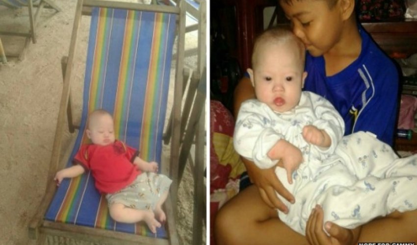 Australian couple abandon surrogate Down's Syndrome baby Australian couple abandon surrogate Down's Syndrome baby