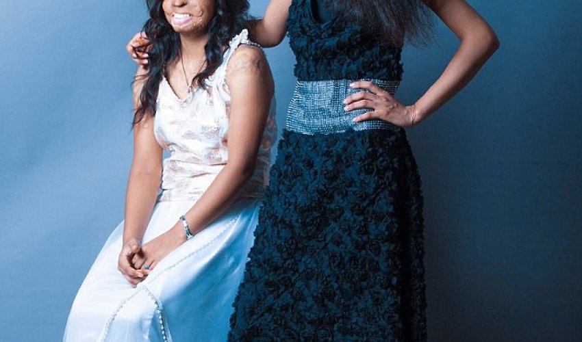 Acid attack survivors unite for inspirational fashion shoot - PHOTO Acid attack survivors unite for inspirational fashion shoot - PHOTO