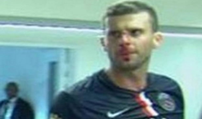 Thiago Motta head-butted