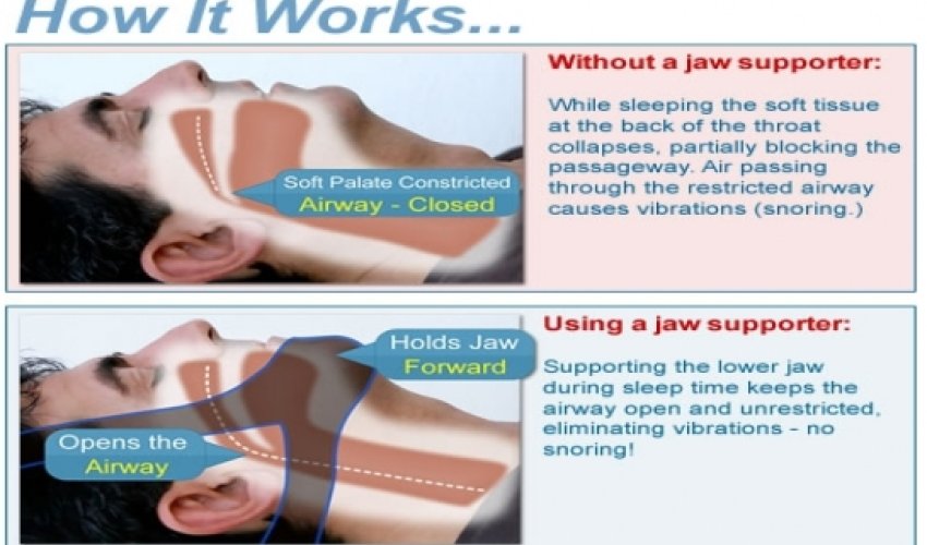 How to stop snoring and sleep well again How to stop snoring and sleep well again
