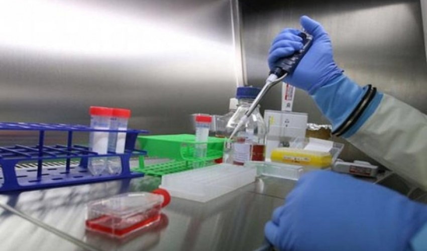 Ebola son 40 ilin ən qorxulu virusudur Ebola son 40 ilin ən qorxulu virusudur