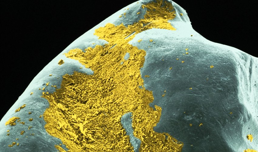 Gruesome 'alien invaders' are the bacteria lurking in the plaque on your TEETH - PHOTO Gruesome 'alien invaders' are the bacteria lurking in the plaque on your TEETH - PHOTO