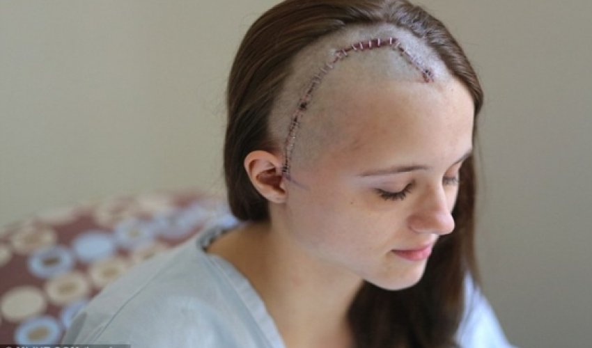 Assault victim reveals her horrific scars - VIDEO