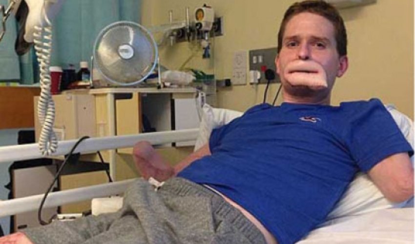 Ən çox yayılan xəstəliklər