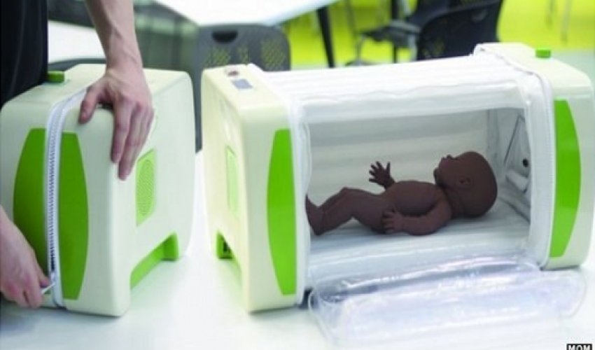 Inflatable baby incubator wins James Dyson Award Inflatable baby incubator wins James Dyson Award