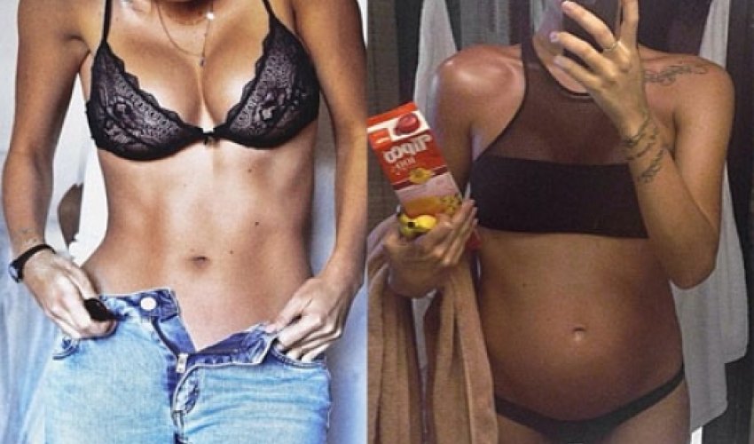 Pregnant woman, 25, branded 'irresponsible' for promoting banana diet Pregnant woman, 25, branded 'irresponsible' for promoting banana diet