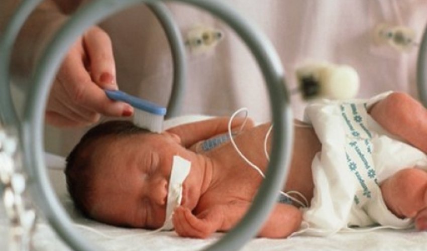 'Kangaroo care' key for premature babies