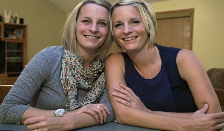 Twin receives breast reconstruction from her sister's STOMACH Twin receives breast reconstruction from her sister's STOMACH