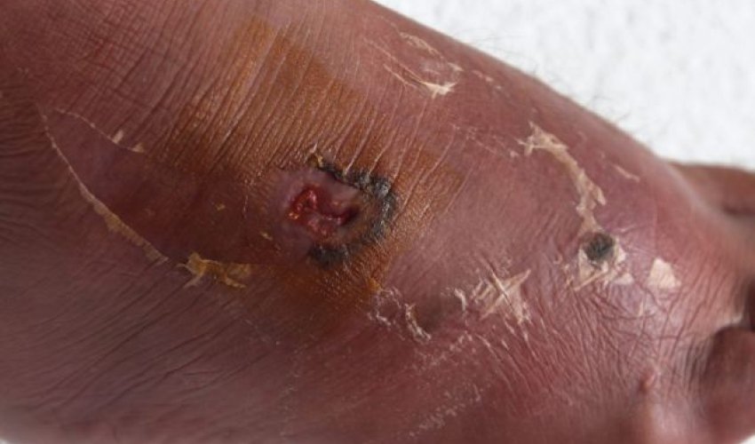 Father dies after STINGRAY attack PHOTO Father dies after STINGRAY attack PHOTO