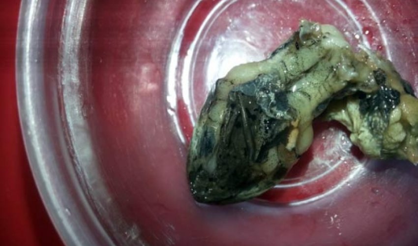 Woman finds ‘snake head’ in frozen bag of green beans Woman finds ‘snake head’ in frozen bag of green beans