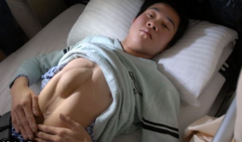 Barber, 24, needs surgery to correct rare defect - PHOTO Barber, 24, needs surgery to correct rare defect - PHOTO