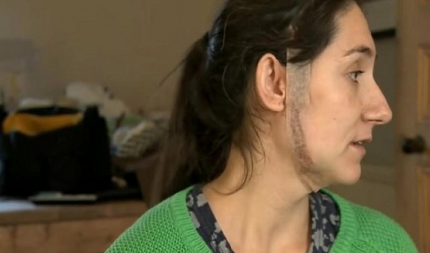 Heavily pregnant woman slashed across the face in ‘random’ attack Heavily pregnant woman slashed across the face in ‘random’ attack