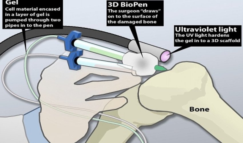 'Bio-pen' could allow doctors to draw-on human cells 'Bio-pen' could allow doctors to draw-on human cells