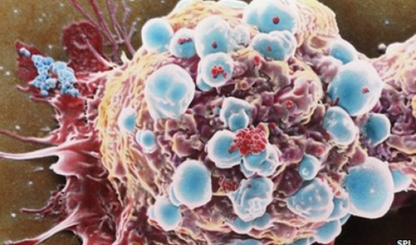 "Sticky balls" stop cancer spreading