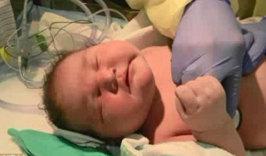 Mother who gave birth to record-breaking baby thought scales were broken Mother who gave birth to record-breaking baby thought scales were broken
