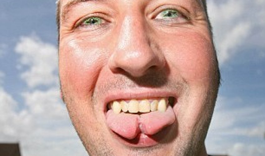 Horn implants, fanged teeth and a forked tongue - PHOTO+VIDEO Horn implants, fanged teeth and a forked tongue - PHOTO+VIDEO