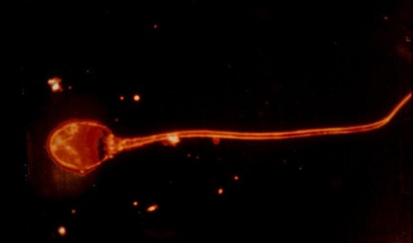 Gentlemen, your sperm is under attack – but don't panic Gentlemen, your sperm is under attack – but don't panic