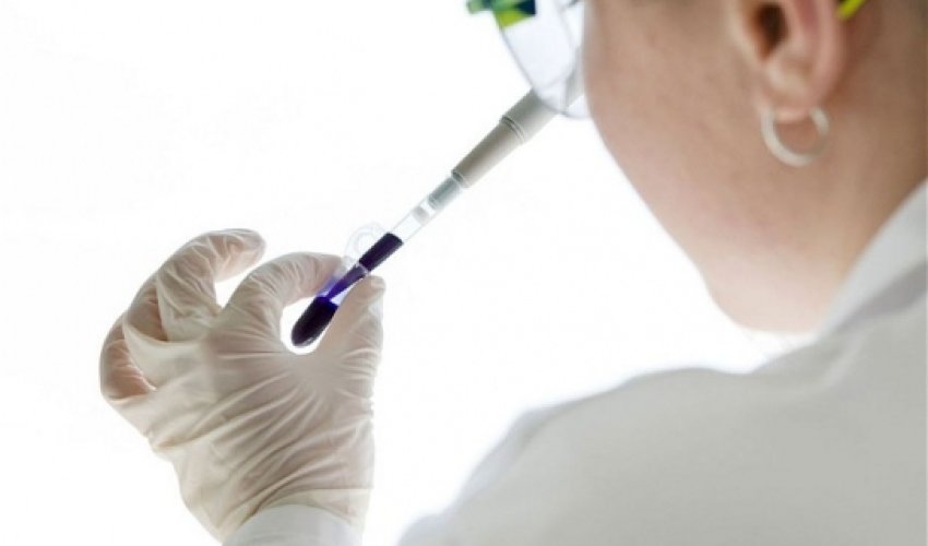 'Death test' predicts chance of healthy person dying within five years 'Death test' predicts chance of healthy person dying within five years