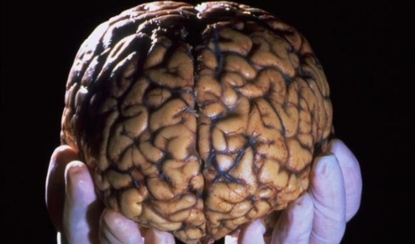 How building a library of brains could save lives