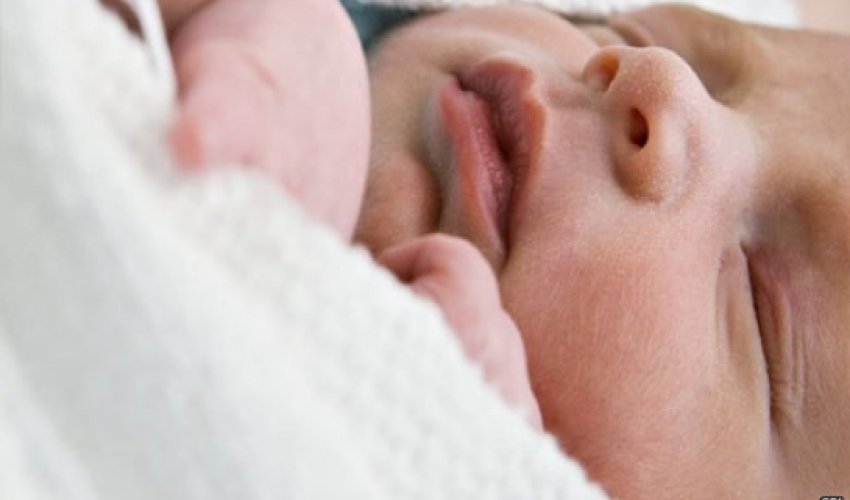 C-section birth "link to later obesity"