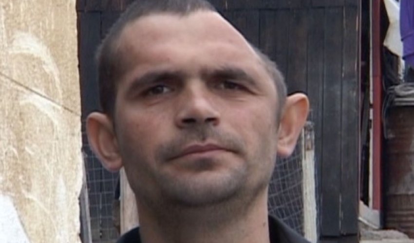 Shocking images of man who lost half of his HEAD - PHOTO+VIDEO Shocking images of man who lost half of his HEAD - PHOTO+VIDEO