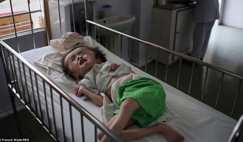 Heartbreaking pictures show even now babies in Vietnam - PHOTO Heartbreaking pictures show even now babies in Vietnam - PHOTO