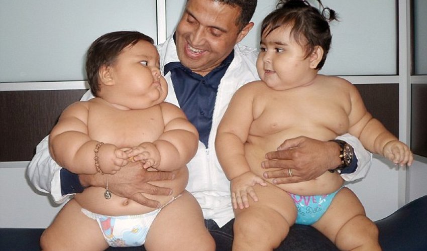 Obese duo sent for special treatment in Colombia - PHOTO Obese duo sent for special treatment in Colombia - PHOTO