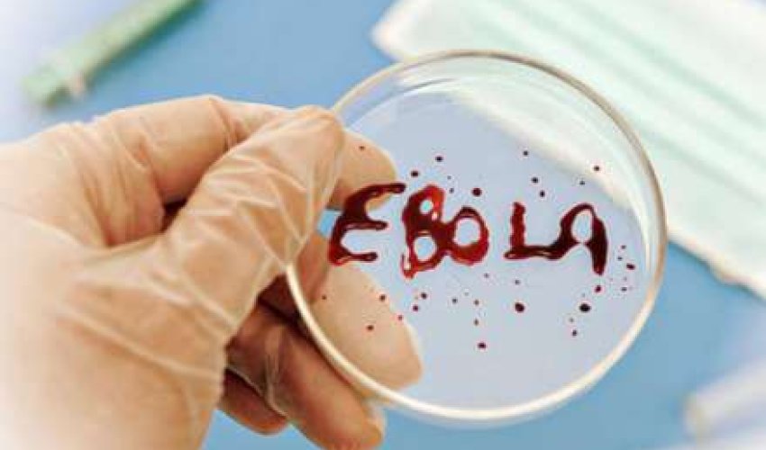 “Ebola” virusunu ABŞ icad edib - İDDİA