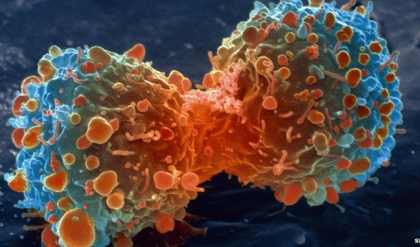 Most cancer types 'just bad luck'