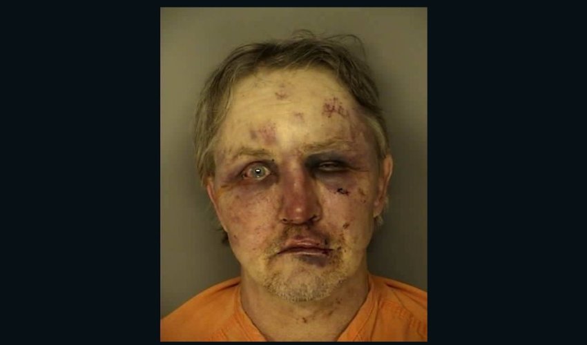 Man arrested in rough shape after alleged sexual assault