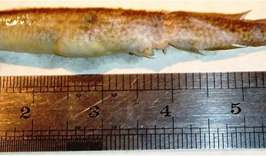 Teenager has 6-inch live EEL gets stuck in his throat for five hours