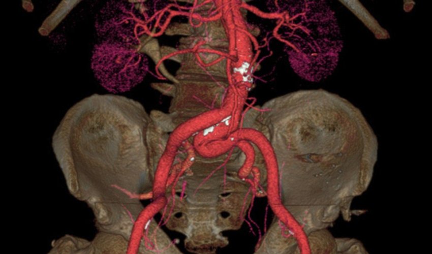 Brains, veins and bones as you've never seen them Brains, veins and bones as you've never seen them