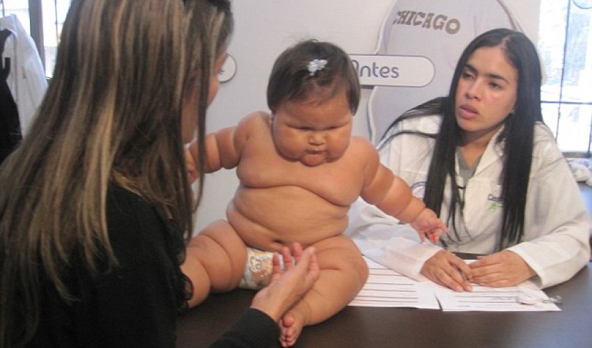 The 10-month-old who weighs as much as a five-year-old