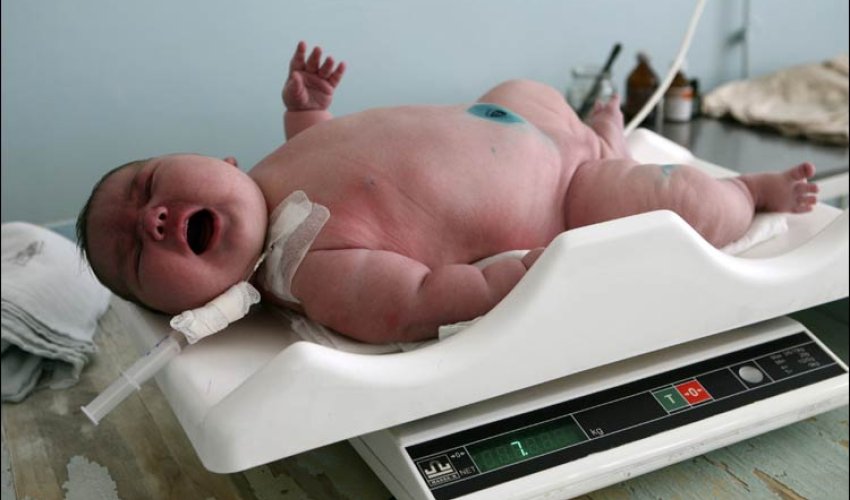 Russian mother has 'giant' baby Russian mother has 'giant' baby