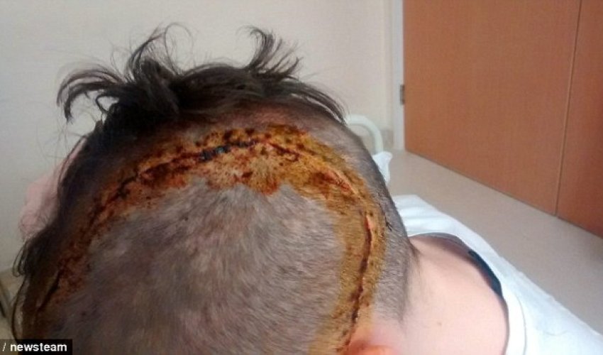 Horrific injuries of 16-year-old boy Horrific injuries of 16-year-old boy