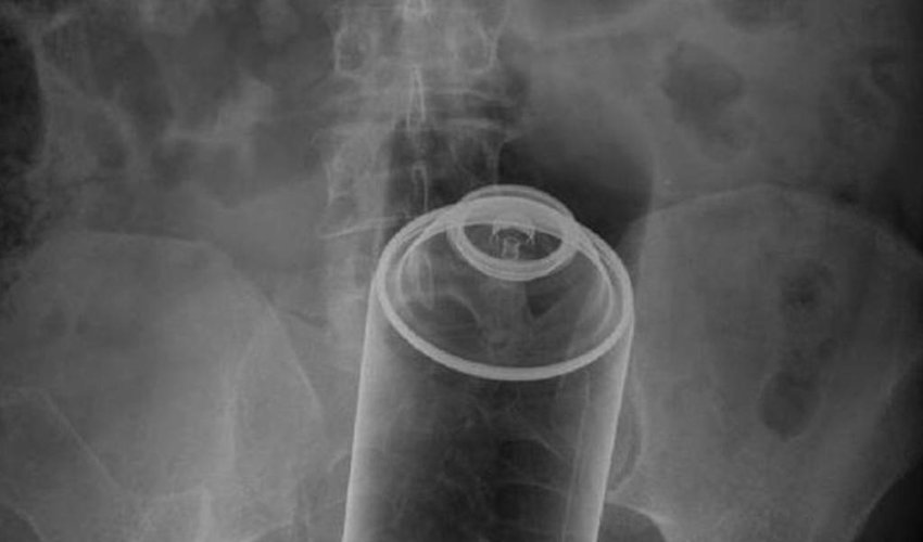 Most unusual X-rays