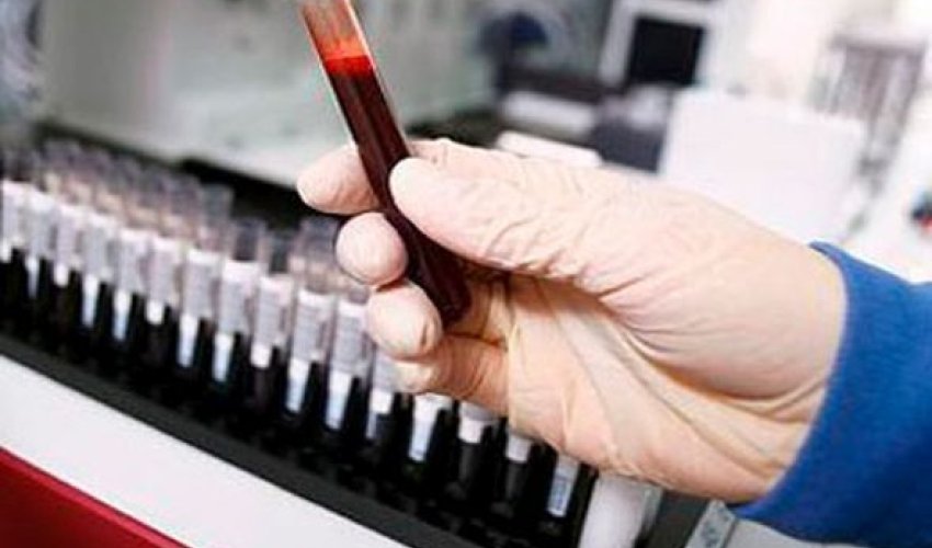 Azərbaycanda talassemiya xəstəliyinin ən çox yayıldığı rayonlar