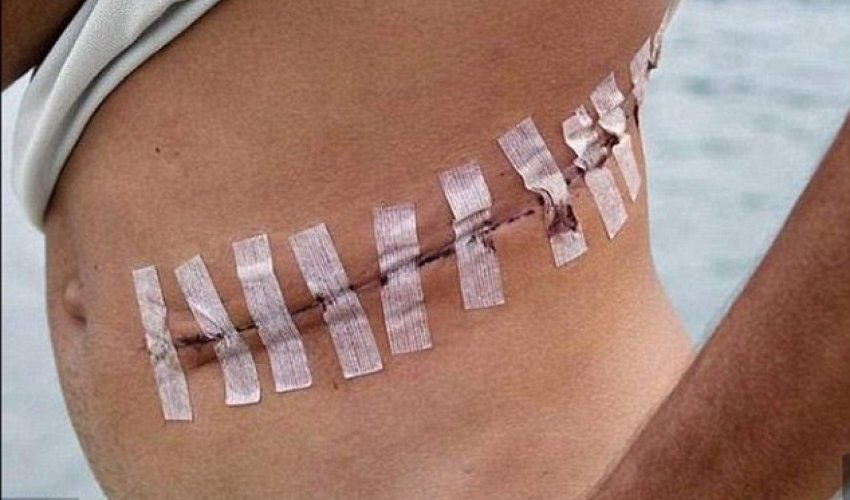 UN urged to investigate ISIS's bloody trade in human organs UN urged to investigate ISIS's bloody trade in human organs
