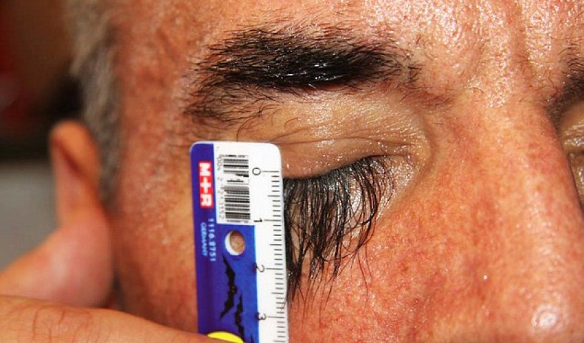 Ukrainian man thinks he has the world's longest eyelashes