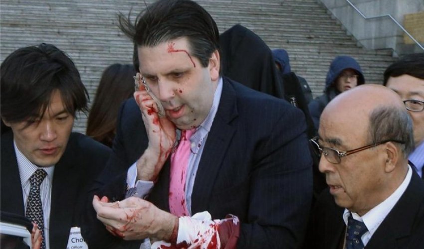 ABŞ səfirinə sui-qəsd