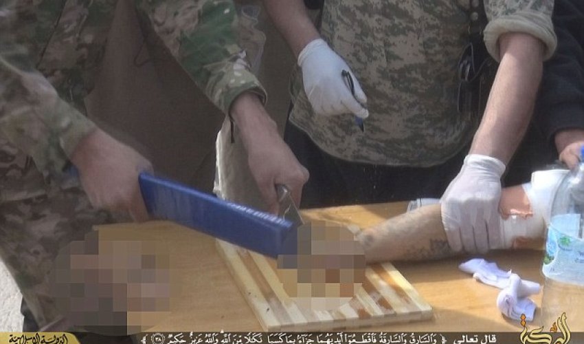 ISIS carry out shockingly crude amputation of 'motorbike thief' ISIS carry out shockingly crude amputation of 'motorbike thief'