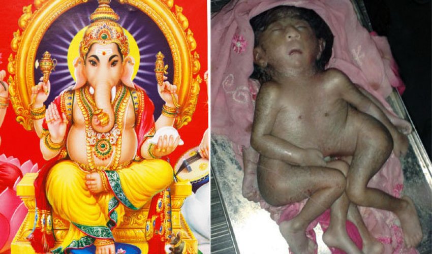 Baby born with EIGHT limbs worshipped as 'Hindu God'