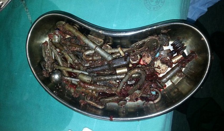 Incredible pictures of 227 metal objects - weighing 4.5lbs Incredible pictures of 227 metal objects - weighing 4.5lbs