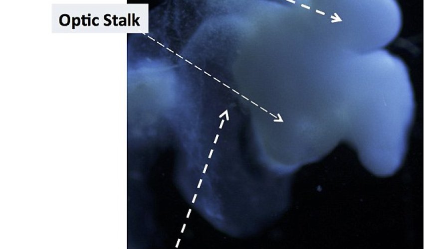 The brain grown in a LAB