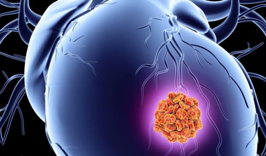 Patch may boost repair after heart attack Patch may boost repair after heart attack