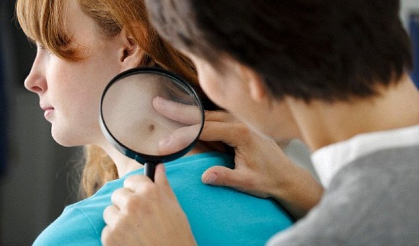 Revealed.. the top 5 warning signs of cancer in young people Revealed.. the top 5 warning signs of cancer in young people